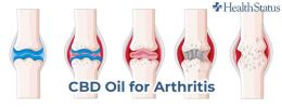 Est-ce que le CBD est bon pour l'arthrose ?